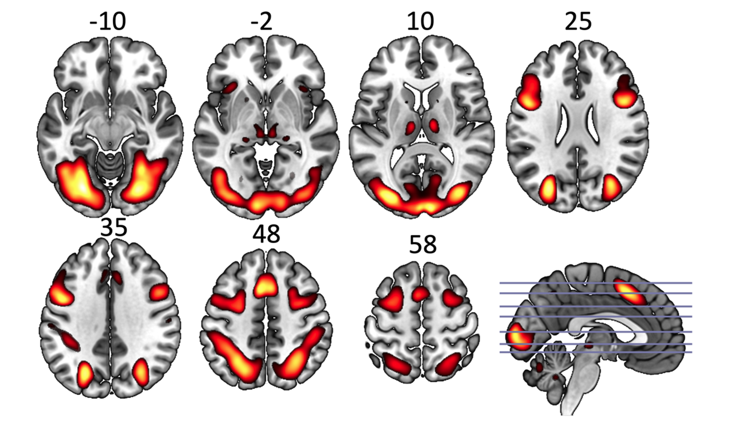 Brain network visualization